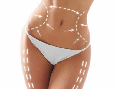 Liposuction Beverly Hills