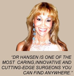 BigSmile | Dr. David Hansen Fillers-Beverly-Hills